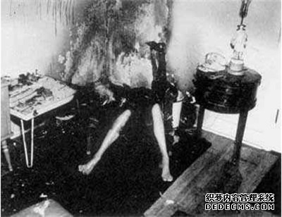 人體自燃之謎:人體自燃是真的嗎 如何才會(huì )產(chǎn)生自燃現象