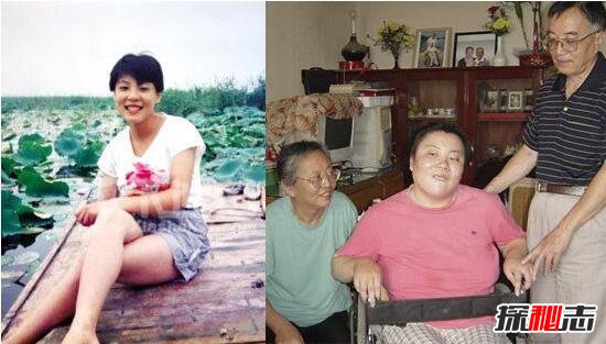 清華鉈中毒朱令事件真相，朱令為什么被投毒(兇手至今逍遙國外)