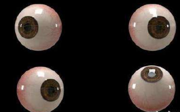世界首個(gè)3D人工眼球問(wèn)世，數百萬(wàn)人將重見(jiàn)光明